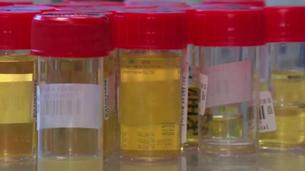 Quelques vertus et avantages spirituels de notre propre urine