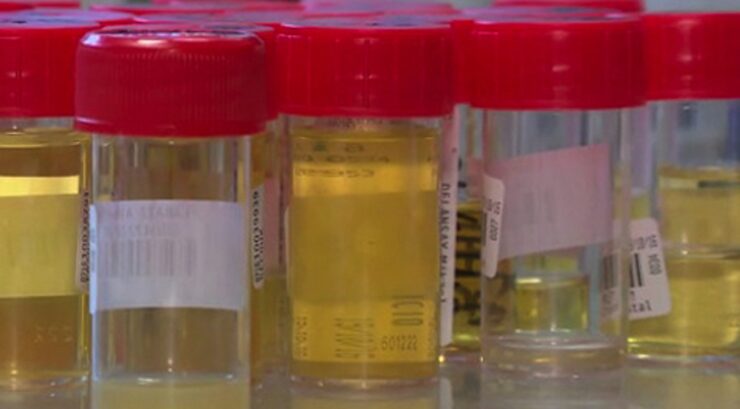 Quelques vertus et avantages spirituels de notre propre urine
